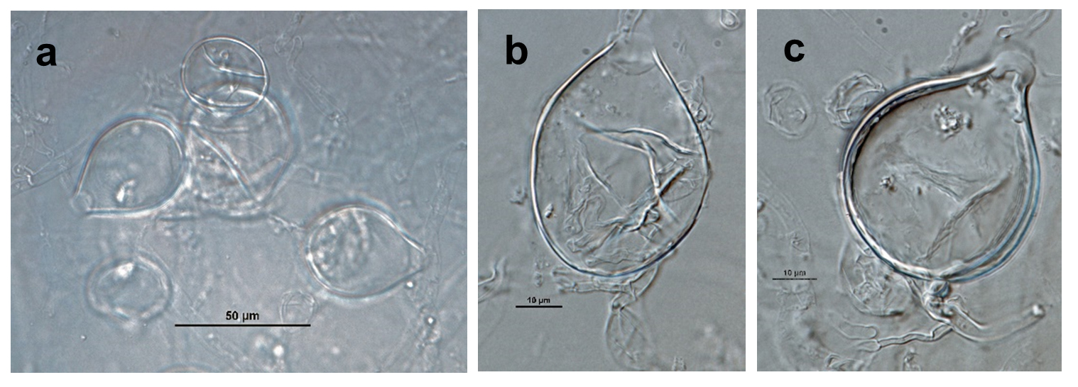 Phytophthora amaranthinbsp; (ex-type CPHST BL 174) asexual phase: (a-c) papillate and semipapillate sporangia; photos by Gloria Abad, USDA-APHIS-PPQ.